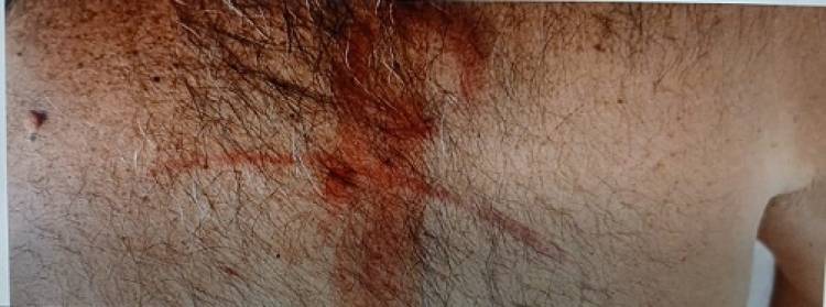 Repudio: Atacan a golpes al normalizador de ATE en Mercedes