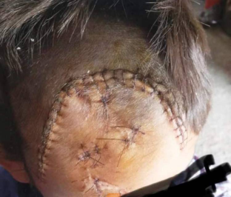 Conmoción y pedido de justicia: MERCEDES investiga brutal agresión a un niño